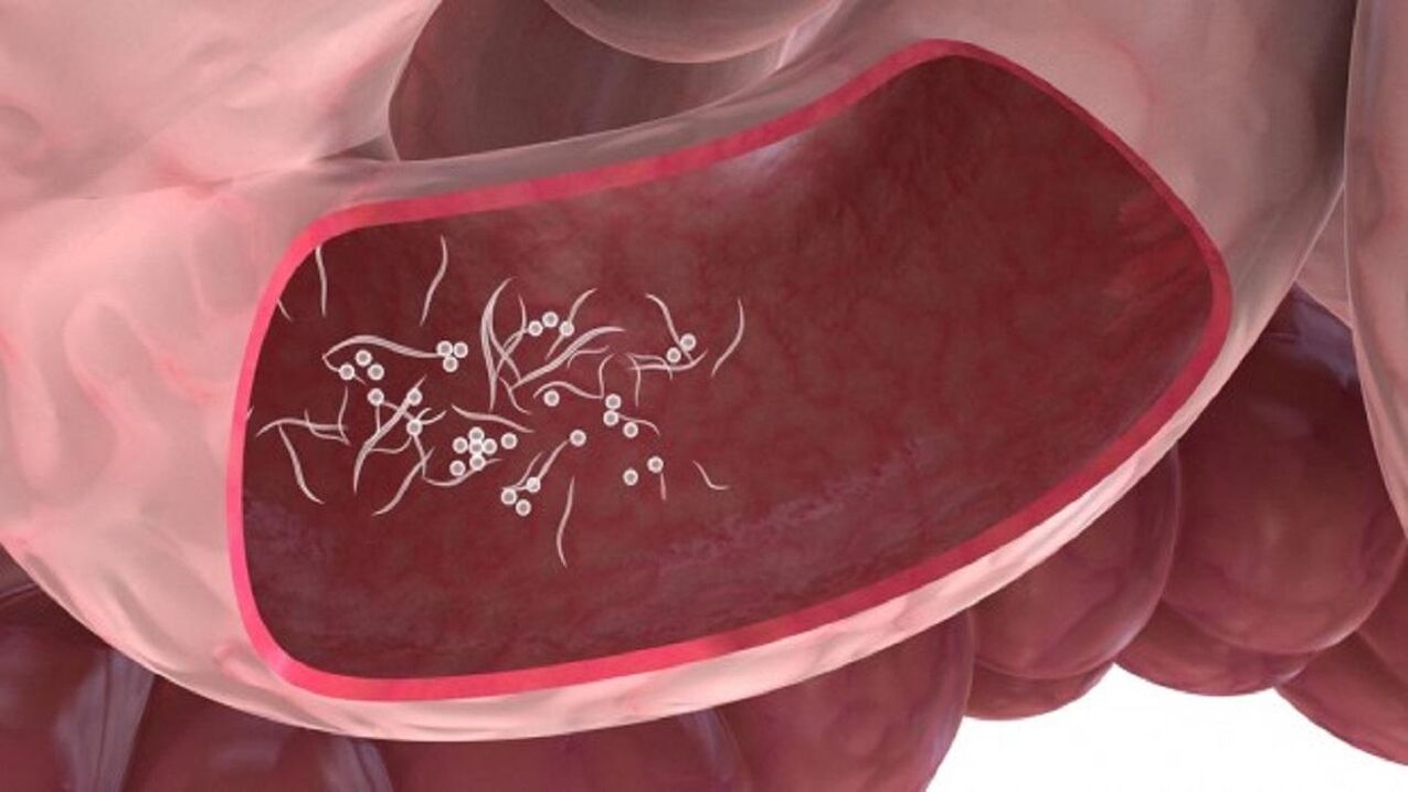 Karaciğerdeki Giardia parazitleri