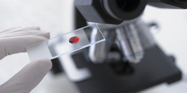 Vücuttaki parazitleri teşhis etmek için kan testi