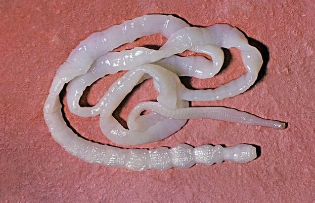 boğa tenyası neye benziyor