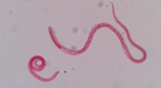 trişinella neye benziyor